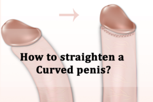 penis straighten penises